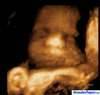 Ecograf&iacute;a 4D 28 semanas de gestaci&oacute;n